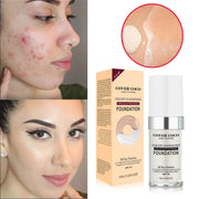 Concealing Foundation Temperature Change Skin Color